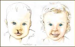 UC Davis Department of Otolaryngology (Ear, Nose & Throat) - Dr. Craig ...